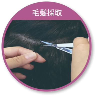 毛髪採取